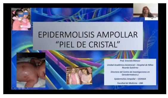 Epidermólisis Ampollar, Dra. Manzur
